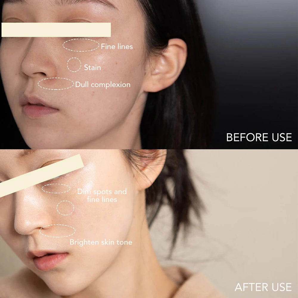 AILKE Dark Spot Corrector Cream SPF35+ – Brightening & Anti-Sun Korean Skincare