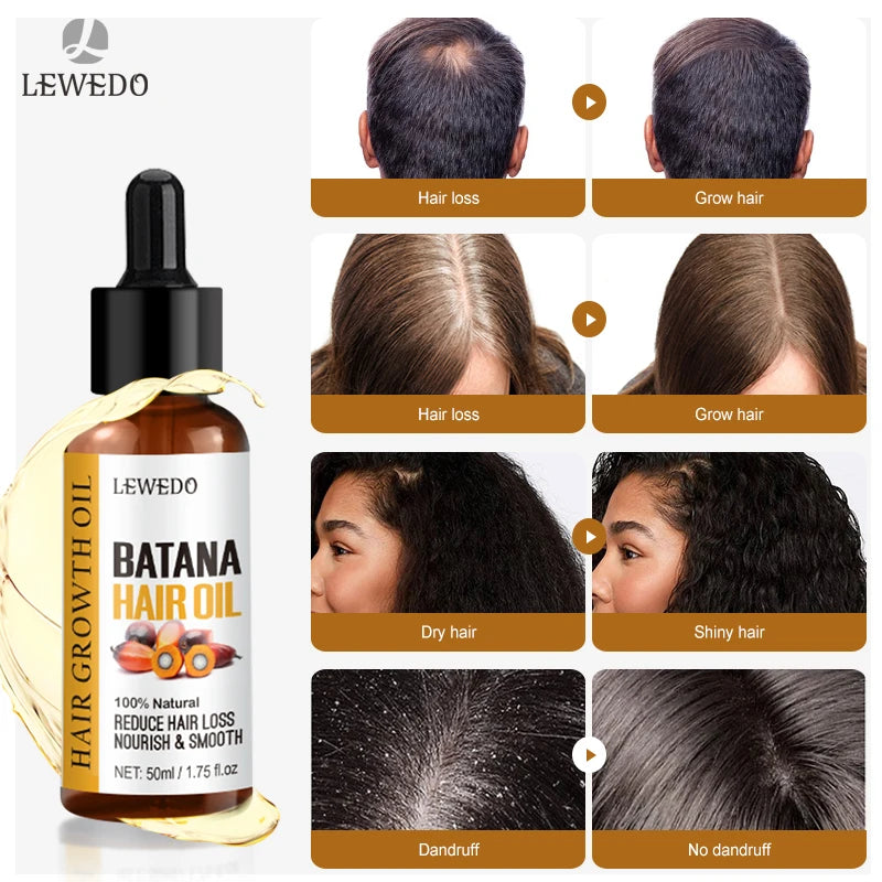 Batana Hair Growth Oil – Fast Regrowth & Repair for Thicker, Stronger Hair