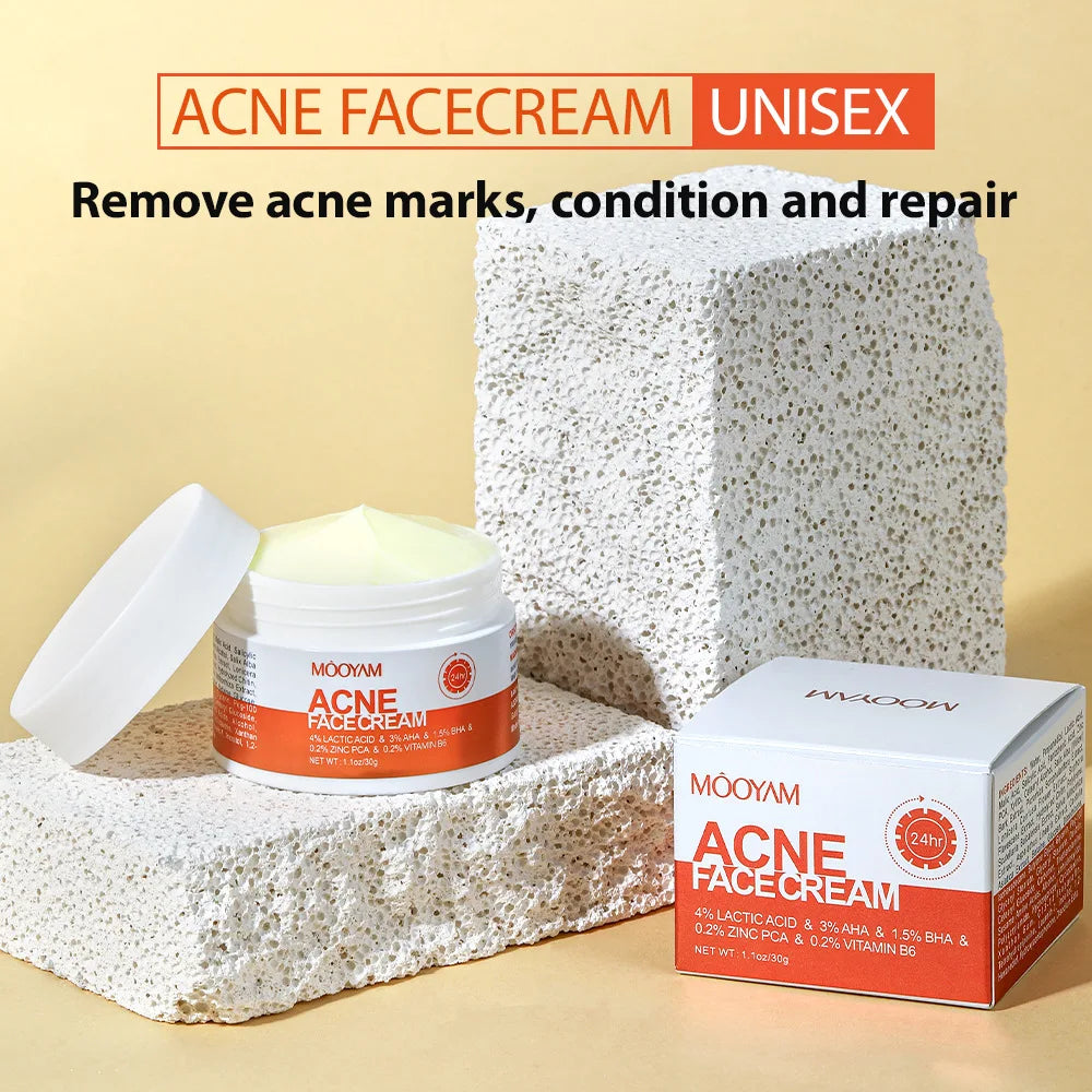 Acne Clear Cream – Smooth Skin Fast