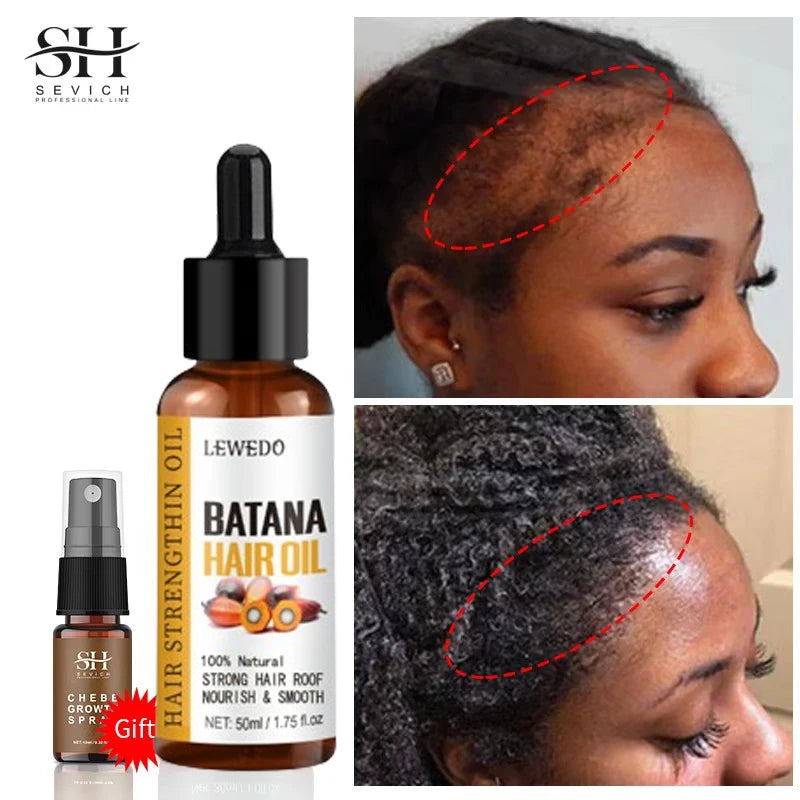 Batana Hair Growth Oil – Fast Regrowth & Repair for Thicker, Stronger Hair