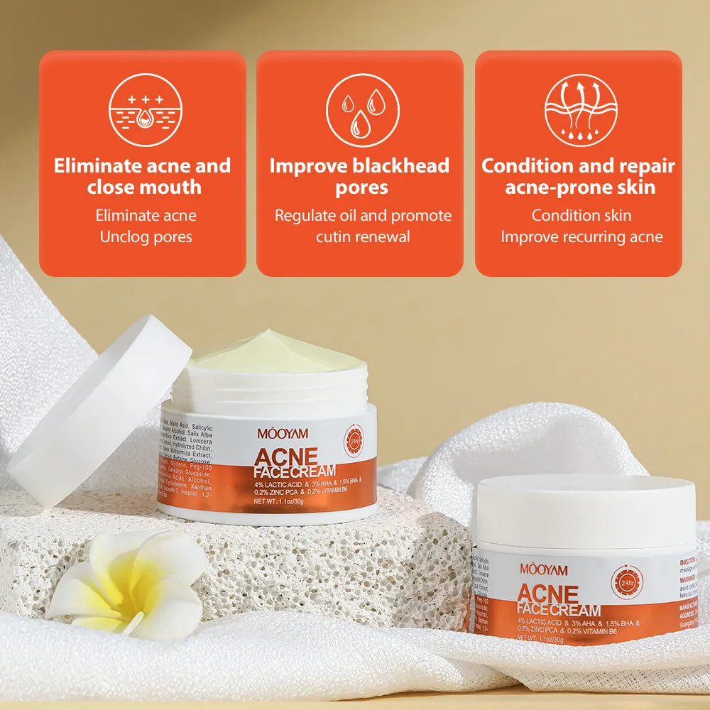Acne Clear Cream – Smooth Skin Fast