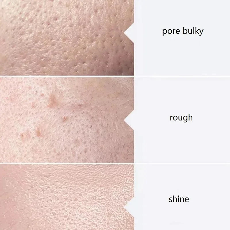 AHA BHA Face Serum – Clear & Glow Skin