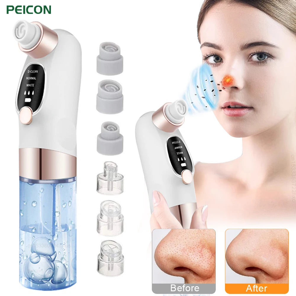 Pore Vacuum Blackhead Remover – Deep Clean & Clear Skin Instantly