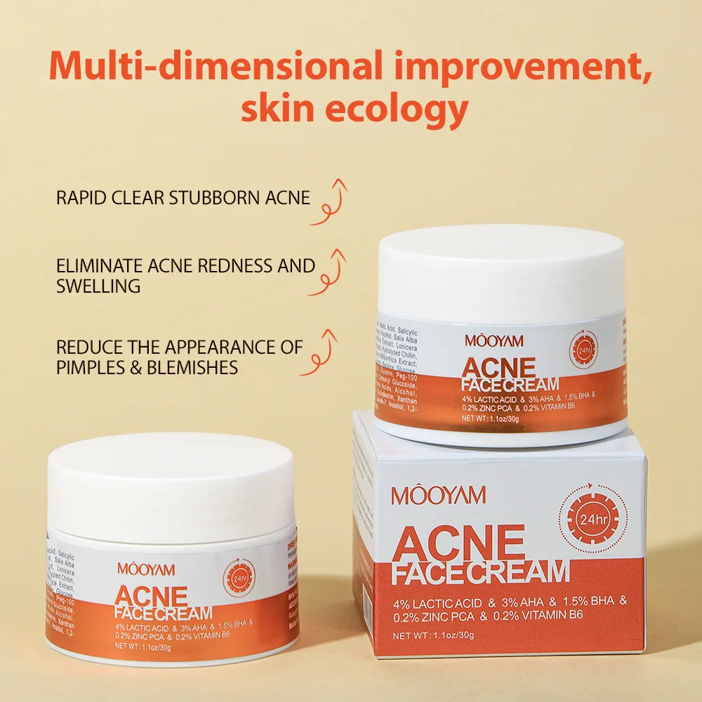 Acne Clear Cream – Smooth Skin Fast