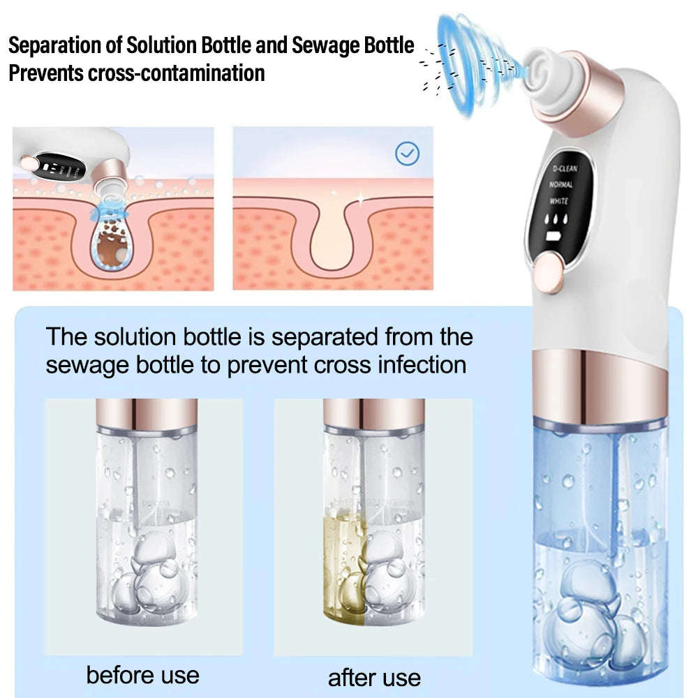 Pore Vacuum Blackhead Remover – Deep Clean & Clear Skin Instantly