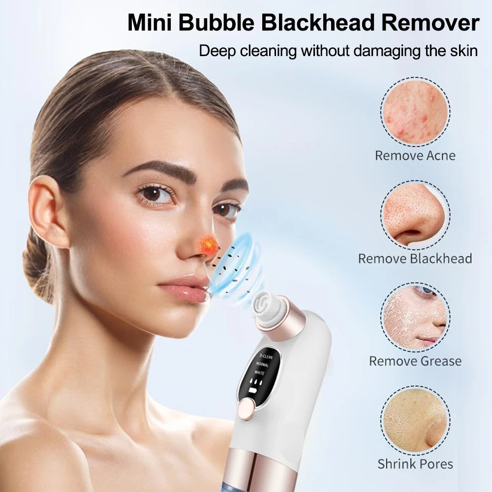 Pore Vacuum Blackhead Remover – Deep Clean & Clear Skin Instantly