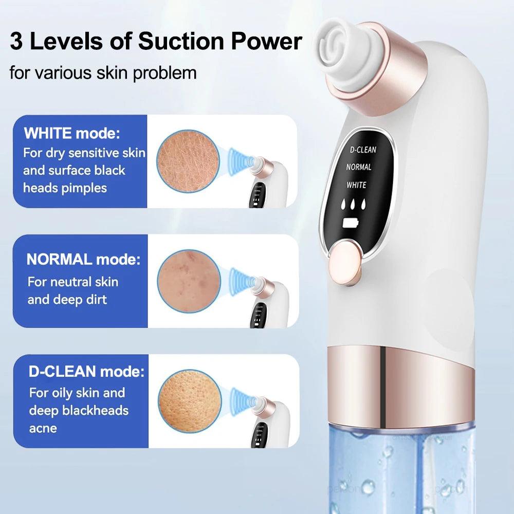 Pore Vacuum Blackhead Remover – Deep Clean & Clear Skin Instantly