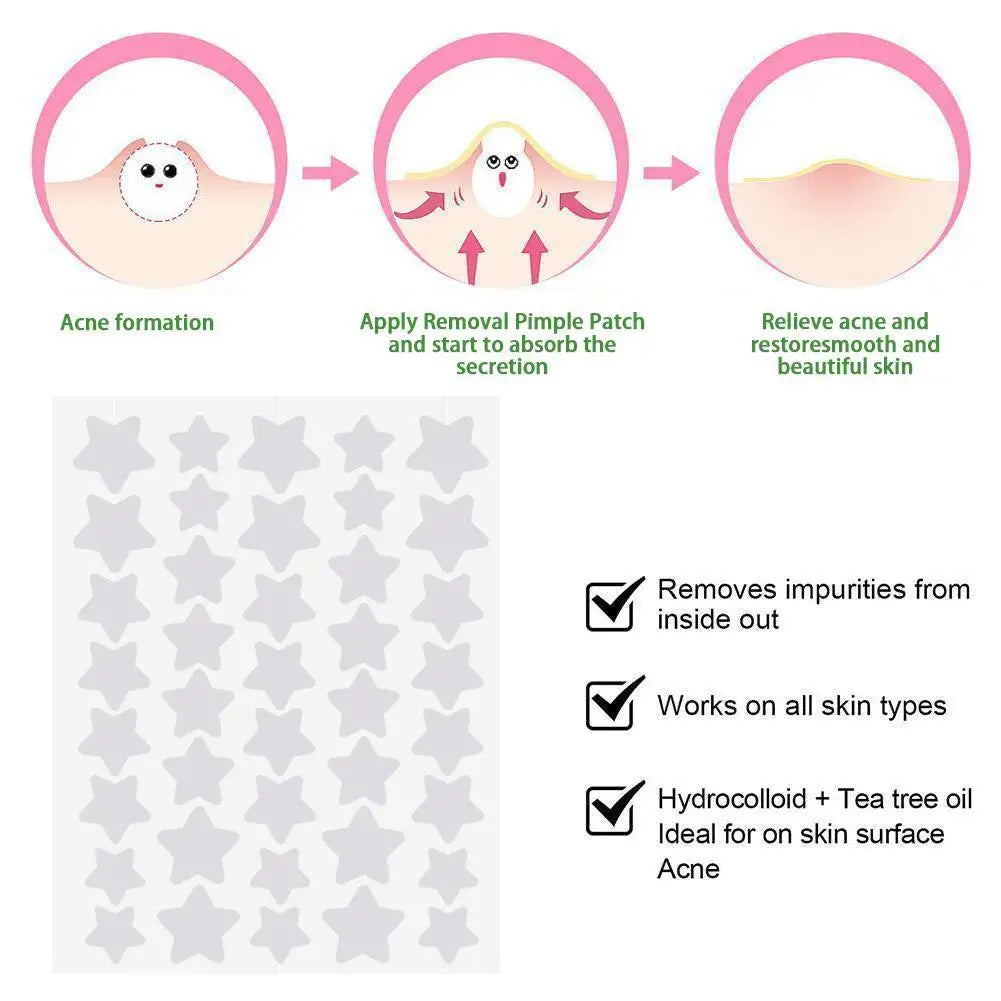 Pimple Patches – Clear Acne Overnight
