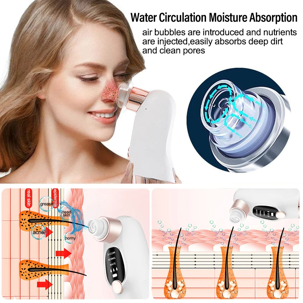 Pore Vacuum Blackhead Remover – Deep Clean & Clear Skin Instantly